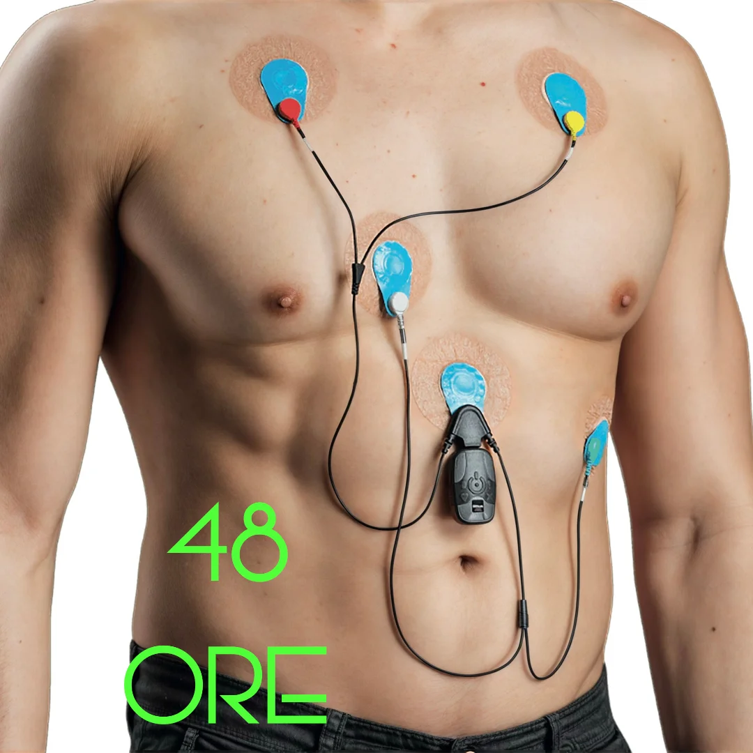 Esame Holter Cardiaco 48 Ore